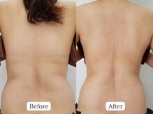 至空院/リンパ＋α