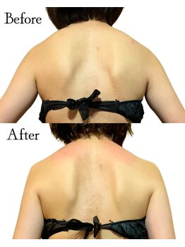 ロイヤルキューティー 介正鍼灸整骨院 コマーシャルモール博多(ROYAL QT)/筋膜リリースリンパドレナージュ