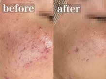 エミルカ 千葉店(EMILUCA)