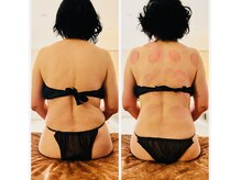 ラクア/筋膜リリース＆ボディケアコース