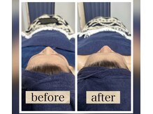 フェイシャルとセットがおすすめです◎