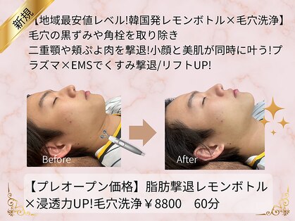 頭のオアシすぱの写真