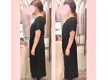 ララスマイル 鶴崎森町店/頭痛 不眠 猫背 首肩こり 整体