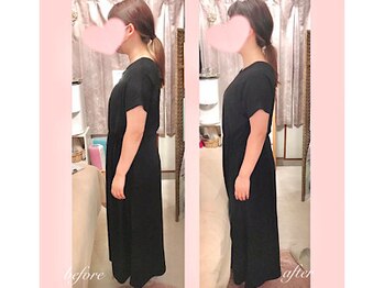 ララスマイル 鶴崎森町店/頭痛 不眠 猫背 首肩こり 整体