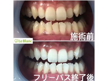 ルブラン 奈良店(Le Blanc)/各種コースたくさん！！