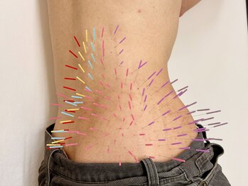 とだ鍼灸院の写真/《八丁堀/24時まで営業/周囲が気にならない完全プライベート空間》緊張せず、安心して1人で通える鍼灸院◎