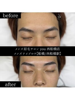 ユー 西船橋店(you)/ビフォーアフター写真