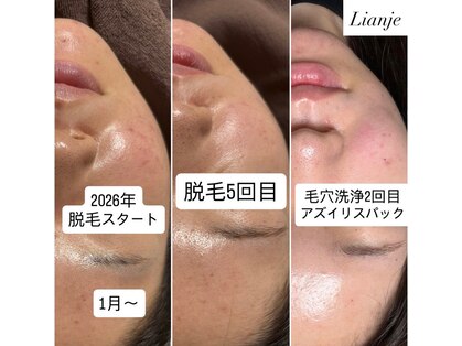 リアンジェ(Lianje)の写真