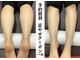 タオフィット(TAO Fit.)の写真