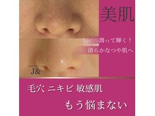 ファミリータイズカンパニーガデス(Family Ties Co. Goddess)の雰囲気（韓国最新ピーリング◎セラピール【小顔/ピーリング/毛穴】）