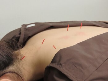 リアン 目黒駅(Re-Ane)/【鍼灸】首肩