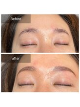 ラ ドウ 名古屋黒川店(la.dow)/ビフォーアフター◎