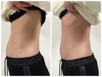 エミット(emit.)/くびれる整体