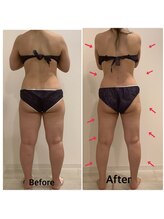 スペチアーレ 夙川/4SET最強痩身で大変身