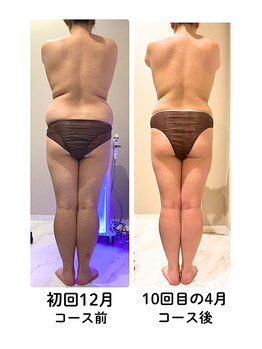 グレッシュ &nbsp;弘前店(Gresh)/★お客様のビフォーアフター★