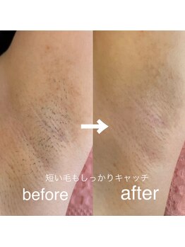 エフ ワクシングブティック(efu.WaxingBoutique)/わき+VIO¥9,600