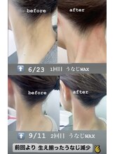 アイズ ビューティケア(eyes. beauty care)/うなじWAX脱毛 ＊ before &nbsp;after