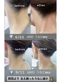 アイズ ビューティケア(eyes. beauty care)/うなじWAX脱毛 ＊ before &nbsp;after