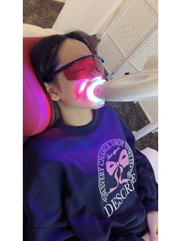 ペルラメディカルホワイトニング 名古屋/自然な白さへ