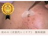 NEW【シミ排出ケア】次世代シミスポットケア※まずは無料相談から