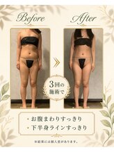 リンガ(Ringa)/3回で実感すっきり変化