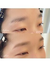 Waxでワントーン明るい肌に！産毛も無くなる事でより眉がはっきりと！【眉メイクの時短に】