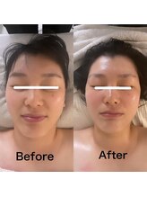 メグリ(Megurii)/施術直後から変化をしっかり実感