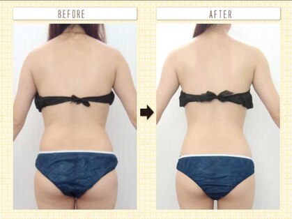 エステアンドトレーニング ビビ(ViVi)の写真