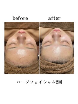 エステティックレイビス 弘前店(RAYVIS)/