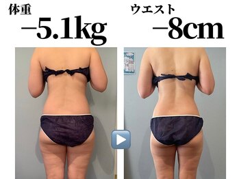 アナパ・オラの写真/【歴17年の痩身術/10キロ以上の減量実績◎】お一人お一人のお身体の体質と状態に合わせたメニューで痩せる!