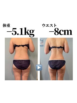 サイズダウンを目指したい