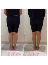 スタイルラボ高松/産後骨盤矯正の効果♪