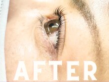 カシェット(cachette...)/おすすめデザイン AFTER