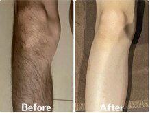 ルタンリッシュオム(Lutan Riche hom)/全身脱毛可能！