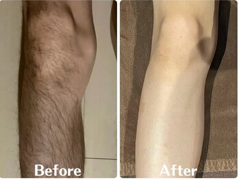 ルタンリッシュオム(Lutan Riche hom)/全身脱毛可能!