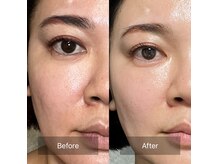 プラスボーテ 北参道(plus beaute)の雰囲気(キレイ肌・可愛くなれる!唯一無二のフェイシャルエステサロン♪)