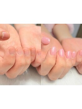 長さ出しのできるサロン