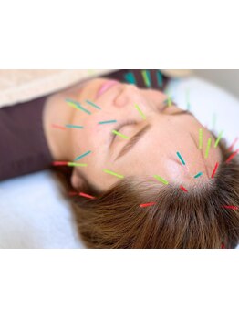 鍼灸施術を受けたい