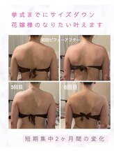 ティアラ(Tiara)/