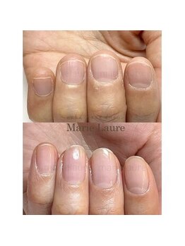 マリーロール 淀屋橋本店(Marie Laure)/深爪矯正/自爪育成/ネイルケア