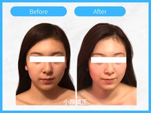 トウメイコガオ 横浜店/トウメイコガオ【ララピール】