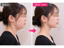 ボディステップ(BODY STEP)/整体で叶える自然な小顔