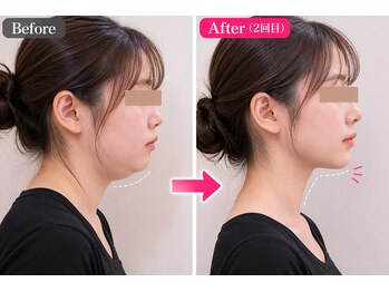 ボディステップ(BODY STEP)/整体で叶える自然な小顔