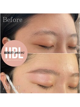 カイリ(Kaire)/ハリウッドブロウリフト