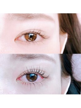 アオ(AO)/＊上下パーマ