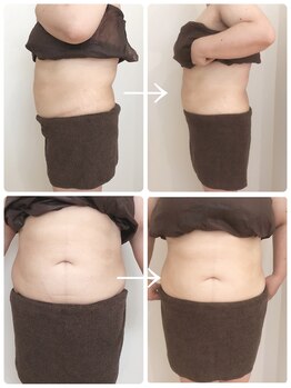 スリムアンドビューティー メゾン ド シュシュ(Slim&Beauty Maison de chouchou)/1ヶ月速攻全身コース