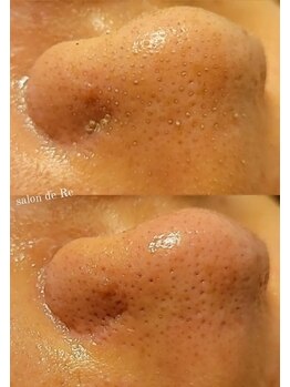 サロンドリー(salon de Re)/超音波エクストラクション