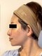 サロン モッズ(SALON MODS)の写真/テラボーラーであなたの表情筋を目覚めさせる！深部の筋肉までアプローチし、血行促進やたるみ改善に◎