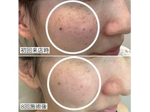 モイラ(MOIRA)の雰囲気（Before→After.シミくすみが美肌に/自信が持てる素肌に）