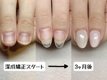 マニエネイル(mani e nail)/自爪育成のアクリルスカルプ